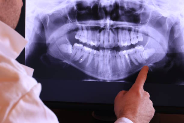 Best Emergency Dentist for Knocked-Out Tooth in Sebastian, FL