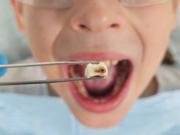 Best Orthodontic Emergency Dentist in Sebastian, FL